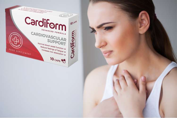 Cardiform pareri forum